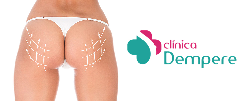 Mamoplastia